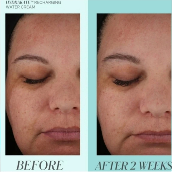 Kate Somerville HydraKate Recharging Water Cream - Picture 4 of 5